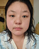 DR.CFUN德國(guó)醫(yī)用級(jí)點(diǎn)痣祛去痣點(diǎn)痣膏官方正品無痕臉部黑痣雀斑點(diǎn)痣疣藥水 【德國(guó)專研】醫(yī)用級(jí)點(diǎn)痣 | 適用于各種痣痦 曬單實(shí)拍圖