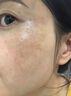 碧素堂祛斑霜美白淡化老年黃褐雀斑去斑去黑色素男士老年斑臉部手背祛斑 強(qiáng)效特效霜:一盒裝【醫(yī)用正品】 專(zhuān)用霜去老人斑淡化淡斑醫(yī)用正品 曬單實(shí)拍圖