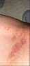 川廿制藥股癬銀屑病專用藥膏大腿內(nèi)側(cè)真菌感染腹股溝股牛皮癬止癢抑菌皮膚 曬單實拍圖