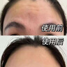 EDRI川字紋貼抬頭紋去除神器男重度額頭皺紋睡覺(jué)貼提拉緊致抗皺女專(zhuān)用 曬單實(shí)拍圖