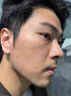 代文痘坑凹洞痘印痘疤凹坑凹陷疤痕男生長(cháng)因子微針可搭祛痘修復凝膠CN 買(mǎi)2送1【3盒】少量痘印痘坑推薦 曬單實(shí)拍圖