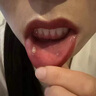 維邦樂(lè )醫用口腔含漱液漱口水消炎殺菌去口臭幽門(mén)螺旋桿菌口腔潰瘍結石牙齦腫痛止出血護齦牙周炎200ml/支*3盒 曬單實(shí)拍圖