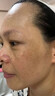 YYTISS377祛斑美白淡斑淡化黑色素藥霜黃褐斑雀斑曬斑女煙酰胺男士專用 曬單實拍圖