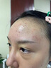 儒意水楊酸祛痘精華痘印修復(fù)淡化痘印控油收縮毛孔去黑色素沉淀護(hù)膚品 40ml 【1滴祛痘】輕度痘肌 紅腫膿痘 曬單實拍圖