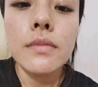 EDRI凍干粉修復屏障增厚角質(zhì)層術(shù)后醫修護褪紅速效補水敏肌2盒裝 曬單實(shí)拍圖