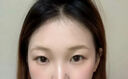 臉部凹陷填充液膠原蛋白太陽穴眼窩淚溝凹陷填充神器面部修復精華 買2送1【3盒裝】臉部凹陷修復 曬單實拍圖