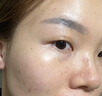 醫(yī)用冷敷貼面膜械字號醫(yī)美術后消炎美白補水曬后修復收縮毛孔祛痘淡化痘印生長因子重組三型人源膠原蛋白敷料 曬單實拍圖