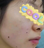 協(xié)南藥業(yè)去痣點(diǎn)痣膏祛痣點(diǎn)痣點(diǎn)疣藥水點(diǎn)痣醫用專(zhuān)用官方正品黑痣臉部不留疤 曬單實(shí)拍圖