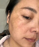 Losoki瑞士進(jìn)口377面膜美白補水淡斑提亮膚色女男士抗皺緊致抗衰老熬夜 曬單實拍圖
