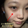 Losoki瑞士進(jìn)口眼膜京東自營(yíng)淡紋眼膜貼眼袋提拉緊致抗皺淡化黑眼圈 曬單實(shí)拍圖