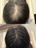 維特絲洗發(fā)水防脫育發(fā)固養(yǎng)發(fā)男女士生姜控油去屑側(cè)柏葉洗頭膏露金榜第1 曬單實拍圖