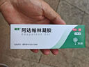 麗芙阿達帕林凝膠16g/盒第三代維a酸乳膏醫(yī)用祛痘印修復(fù)淡化痘印痘坑修復(fù)祛痘藥膏去黑頭收縮毛孔粗大修復(fù) 曬單實拍圖