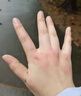 冭川制藥蚊蟲(chóng)叮咬止癢消腫嬰兒寶寶兒童成人清涼便攜舒緩滾珠全家適用 曬單實(shí)拍圖