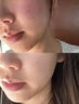 杜莎之謎小黑瓶小紅瓶精華液源碼水光原液敏感肌補(bǔ)水保濕修護(hù)正品防偽可查 小紅瓶（械）1只-贈工具包 防偽可查-正品保障 曬單實(shí)拍圖