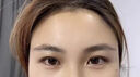 臉部凹陷填充液膠原蛋白太陽(yáng)穴眼窩淚溝凹陷填充神器面部修復精華 買(mǎi)3送2【5盒裝】不反彈 曬單實(shí)拍圖