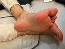 狼毒腳氣噴劑止癢脫皮爛腳丫真菌感染抑菌身體護理外用水泡型非藥腳汗出汗腳臭男女正品噴霧 腳爽噴劑1瓶【100ml】 曬單實拍圖