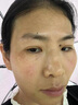 片仔癀美白淡斑套裝淡化黑色素老年黃褐雀斑曬斑提亮去黃祛斑霜護膚品女 五件套【潔面+水+乳+精華+霜】 曬單實拍圖