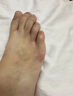 傾姿堂腳氣噴劑止癢脫皮爛腳丫真菌感染去水泡型腳汗腳臭專(zhuān)用噴霧35ML 曬單實(shí)拍圖