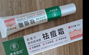 素秀臣氏祛痘膏去痘痘和青春痘痘坑修復粉刺青少年初高中生男女30g 曬單實拍圖