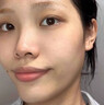 ALORMIRV法國面膜抗皺緊致抗衰老補(bǔ)水美白淡斑面膜去黃提亮膚色祛痘男女士 3盒24片【抗皺抗老新體驗(yàn)】 曬單實(shí)拍圖
