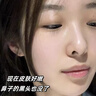 維特絲（vetes）去角質(zhì)面部啫喱控油保濕洗面奶男女士清潔毛孔黑頭閉口溫沒(méi)激素和 【6大專(zhuān)利】果酸去角質(zhì)啫喱200g 曬單實(shí)拍圖