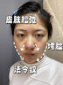 德國家用美容儀器臉部提拉緊致光子嫩膚面部按摩導入儀法令紋神器 【德國進(jìn)口機芯】13極變頻提拉緊致 曬單實(shí)拍圖