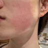 Newliann醫用重組三型人源化膠原蛋白乳液修復敷料凝膠人表皮生長(cháng)因子面霜 曬單實(shí)拍圖