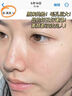 維特絲（vetes）去角質(zhì)面部啫喱控油保濕洗面奶男女士清潔毛孔黑頭閉口溫沒激素和 【6大專利】果酸去角質(zhì)啫喱200g 曬單實(shí)拍圖