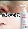 同仁堂氨基酸洗面奶控油祛痘除螨蟲(chóng)去黑頭縮毛孔深層清潔男女士300g 曬單實(shí)拍圖