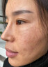 片仔癀祛斑霜美白淡化黑色素老年黃褐雀曬斑煙酰胺去黃提亮膚色男女面霜 1瓶【美白淡化】 曬單實拍圖
