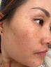 YYTISS377祛斑美白淡斑淡化黑色素藥霜黃褐斑雀斑曬斑女煙酰胺男士專用 曬單實(shí)拍圖