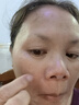 同仁堂脂肪粒去除神器眼部專用去眼部脂肪粒消汗管瘤眼袋清肌顆粒教師節(jié) 曬單實(shí)拍圖