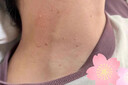 維A酸乳膏去疣體特新效期藥扁平疣專用藥去疣類藥膏去脖子小肉粒頸部瘊子去尤瘊小肉粒去疣膏瘊子肉刺肉粒 1盒裝【國藥準(zhǔn)字脫疣瘊】 瘊子去除國藥準(zhǔn)字藥膏  放心購買 安心售后 曬單實(shí)拍圖