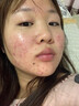 BEAUTY NOTES硫磺洗面奶控油祛痘除螨蟲去黑頭青少年女男士專用潔面乳洗臉皂 曬單實拍圖
