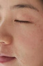 LOSIKVAS醫用械字號洗面奶狀泡沫潔面乳醫美控油祛痘除螨蟲(chóng)去黑頭男士女士 曬單實(shí)拍圖