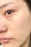 焦博士日本熊果苷乳膏煙酰胺凝膠377美白祛斑霜祛斑美白淡化黑色素面霜 曬單實(shí)拍圖