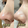 維特絲去黑頭鼻貼清潔泥膜收縮毛孔深層清理粉刺鼻膜神器撕拉面膜男女士 曬單實(shí)拍圖