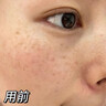 韓方五谷水楊酸祛痘控油面膜補(bǔ)水保濕緊致抗皺熬夜清潔黑頭毛孔修復(fù)女男士 曬單實(shí)拍圖