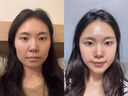 OHBT黃芪面膜10片抗皺緊致抗衰老補水熬夜美白淡斑女男士金榜第1名 曬單實拍圖