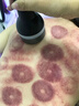 黑美人隔空爆減體雕儀疏通經(jīng)絡(luò)做身體刮痧排濕塑形儀器美容院專用 單頭+負(fù)壓 曬單實(shí)拍圖