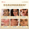 Vinsic美白丸內(nèi)服膠原蛋白肽抗衰老淡斑褪黑美白全身內(nèi)調(diào)去黃提亮暗沉 4瓶裝【褪黑煥白，3瓶+贈1瓶】 曬單實拍圖