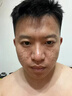 痘坑修復凹洞痘印痘坑修復填充再生長(cháng)因子祛痘印淡化修復痘疤特效 【一盒裝】 曬單實(shí)拍圖