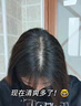 歐華蔻洗發(fā)水男女士二硫化硒去屑止癢控油持久蓬松洗頭膏露液金榜 曬單實(shí)拍圖