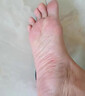 CNDK足部真菌王腳氣腳癢水泡脫皮腳臭香港腳腳汗?fàn)€腳丫真菌感染止癢膏 濃度999+【強效款嚴(yán)重腳氣】 曬單實拍圖