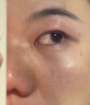 修正紅外鼻敏貼過敏性鼻竇炎成人兒童專用鼻癢塞通氣鼻炎貼膏藥貼 曬單實拍圖