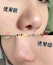 韓方五谷去黑頭鼻貼清潔泥膜祛粉刺深層清潔毛孔鼻膜神器撕拉面膜男女士 曬單實(shí)拍圖