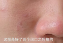 透真果酸濕敷水爽膚水提亮熬夜收縮毛孔粗大修復細致控油祛痘保濕 曬單實(shí)拍圖
