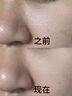 儒意（RUYI）VC爽膚水500ml濕敷水補水保濕水抗皺緊致護膚化妝去黃提亮精華水 曬單實拍圖