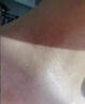 維A酸乳膏去疣體脫落膏祛疣非進(jìn)口扁平疣去疣醫用絲狀疣跖疣脖子頸部專(zhuān)用藥去除脖子小肉粒面部扁平苔疣 2盒【標準裝】 曬單實(shí)拍圖