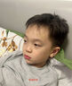 廾卜制藥去痣點(diǎn)痣膏正品無(wú)痛無(wú)痕祛痣膏水專(zhuān)用臉部不留疤痕修復液男女士 曬單實(shí)拍圖